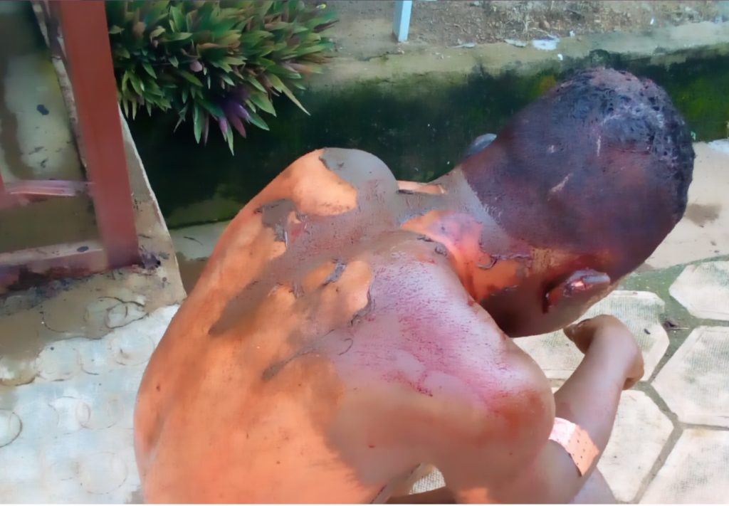 N’ZEREKORE : un présumé voleur frôle la mort